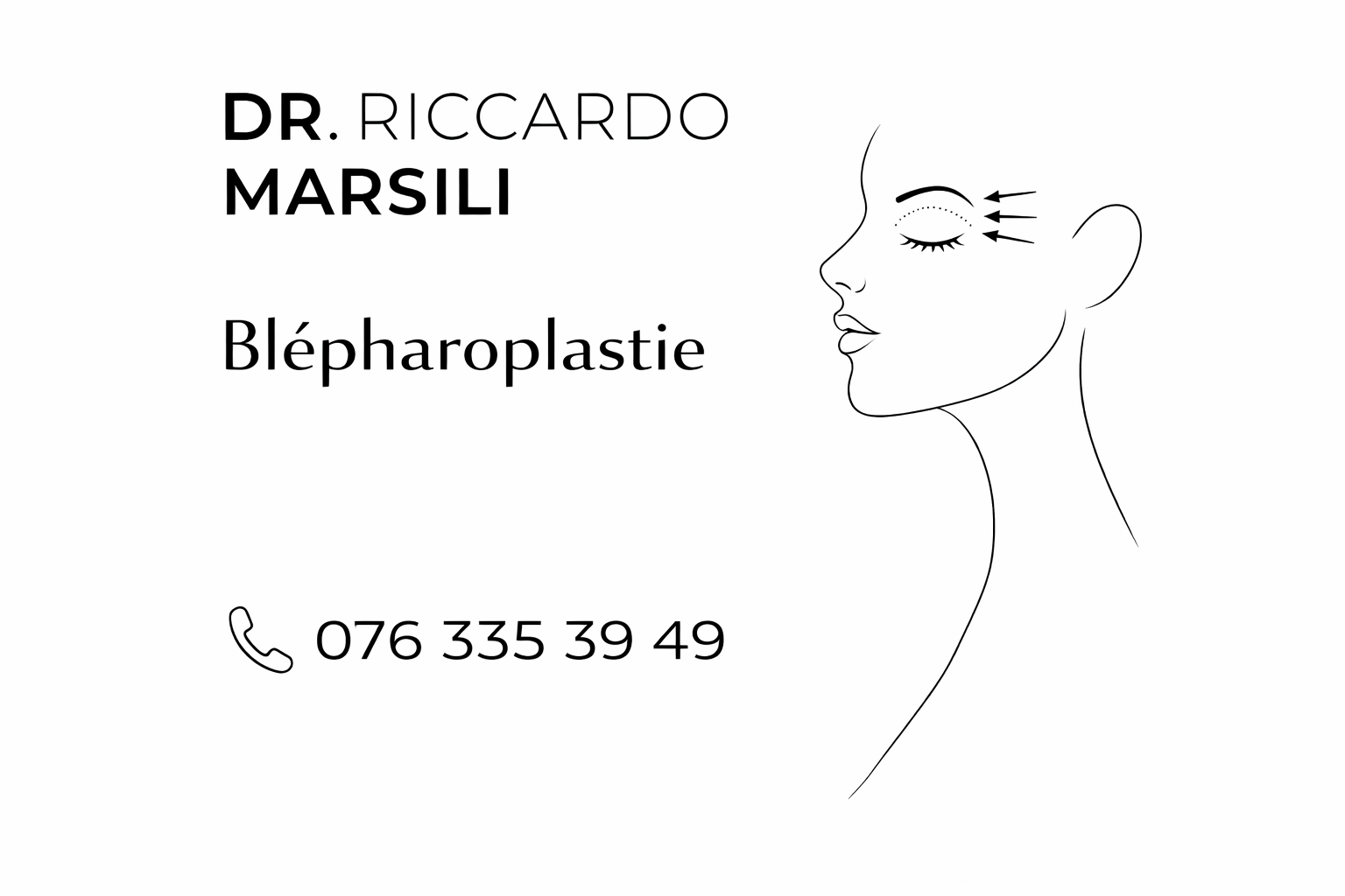 Blépharoplastie à Lausanne : rajeunir le regard en toute sécurité